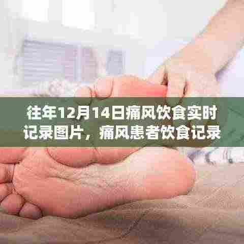 痛风患者饮食实录,往年痛风饮食实时记录图片指南与痛风患者饮食记录分享