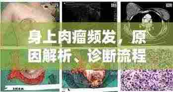 身上肉瘤频发,原因解析、诊断流程与治疗方法探讨