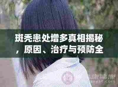 斑秃患处增多真相揭秘,原因、治疗与预防全攻略